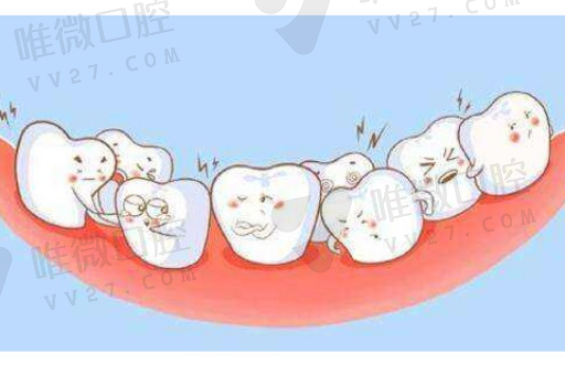 微创种植牙有缺点吗（现在种植牙都是釆用微创种植吗）(图1)